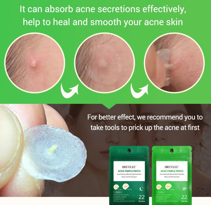 Tea Tree Hydrocolloid Spot Patches, Ultra-Thin and Invisible