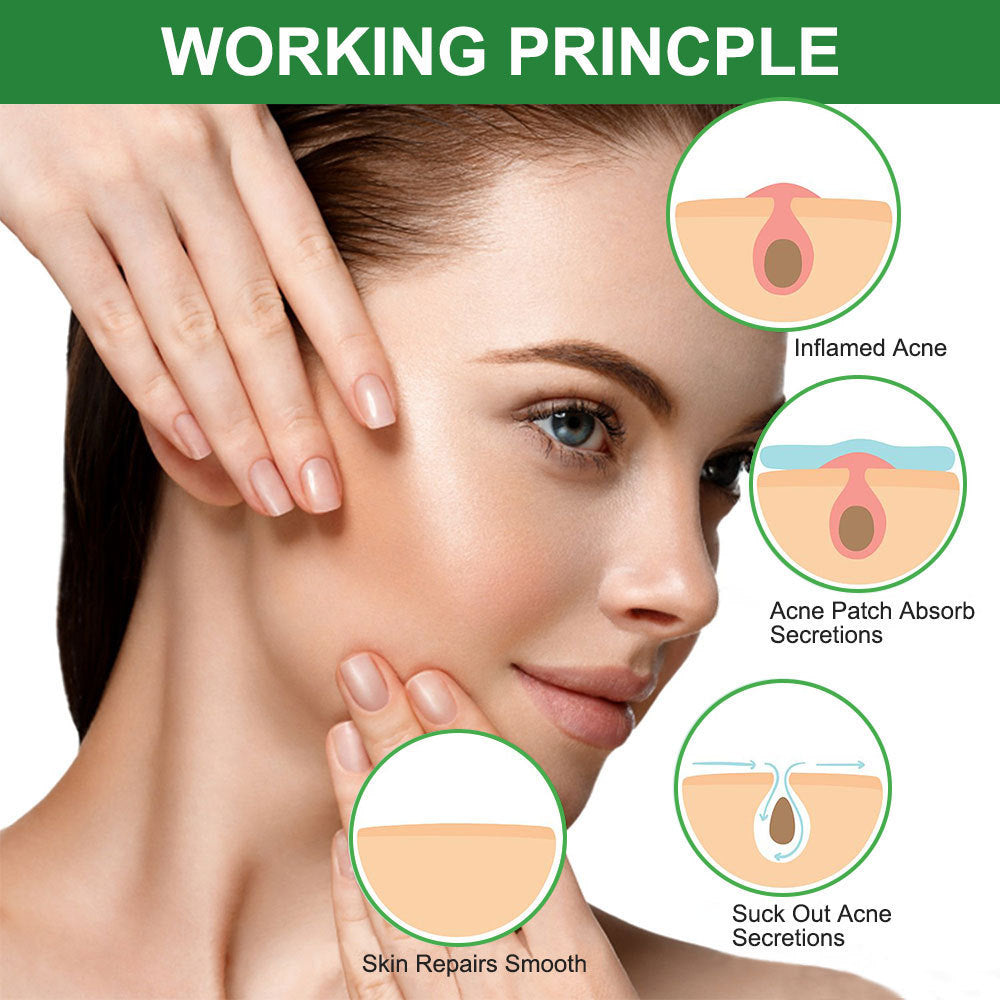 Invisible Hydrocolloid Spot Patches in 3 Sizes