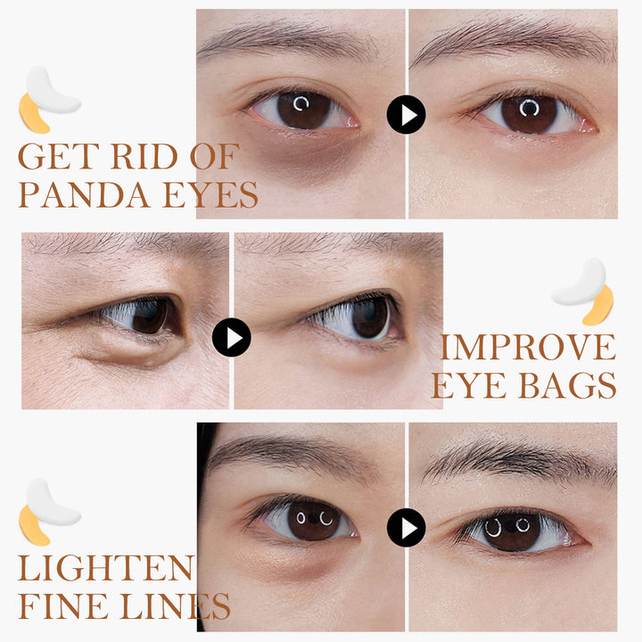 Gold Collagen Eye Patches for Puffy-Looking Eyes