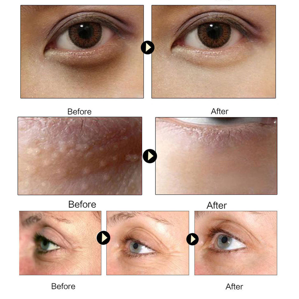 Gold Collagen Eye Patches for Puffy-Looking Eyes