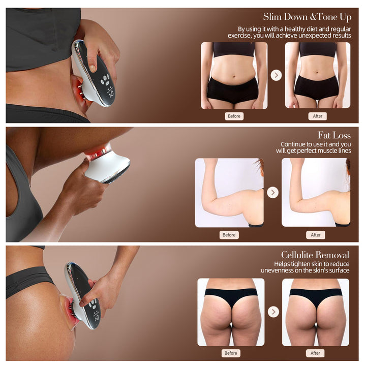 Smart Cupping Massager with 4 Cups and Red Light