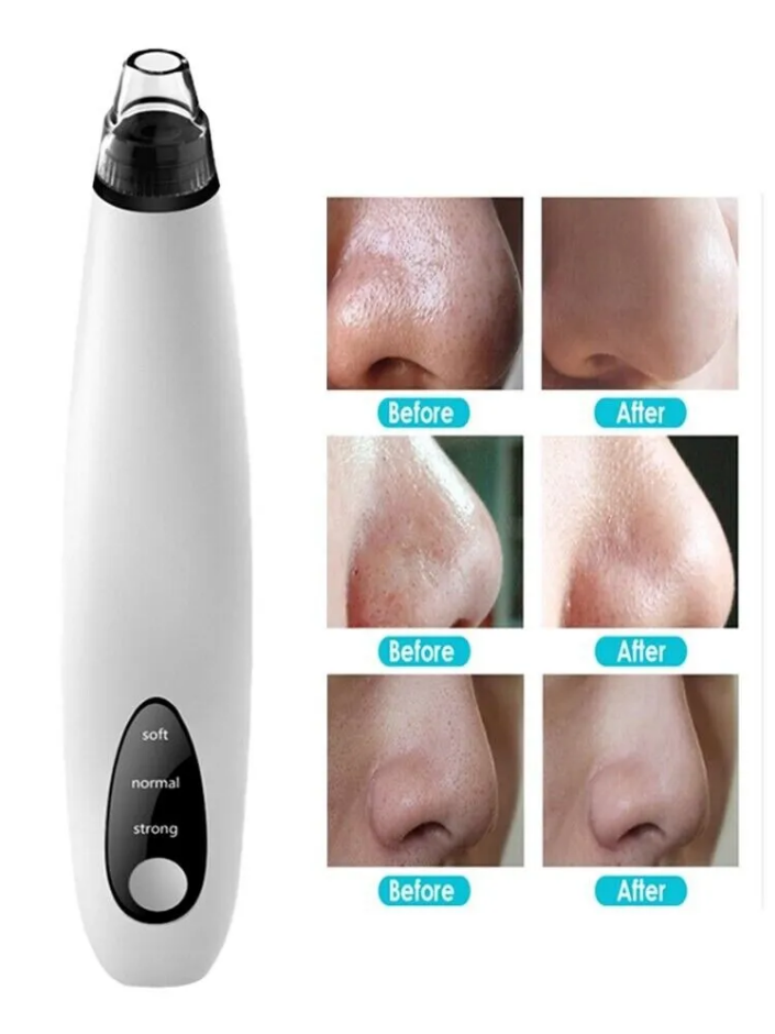 Electric Blackhead Remover Vacuum with Diamond Tip