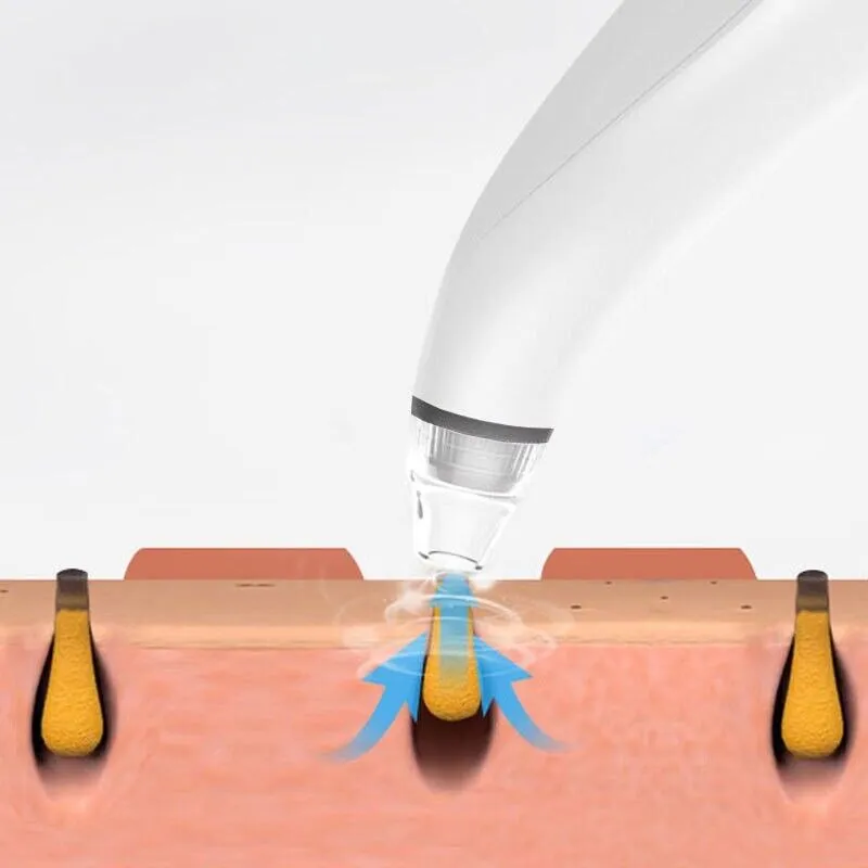 Electric Blackhead Remover Vacuum with Diamond Tip