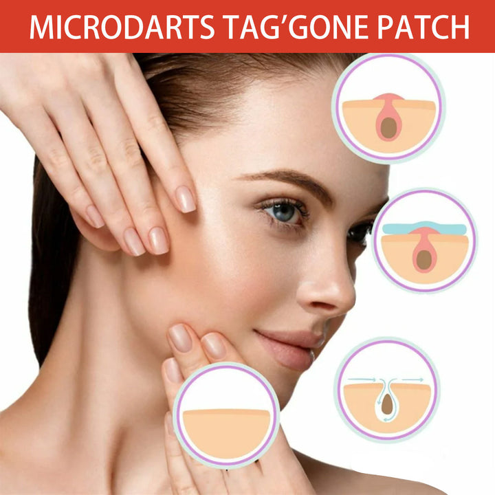 Tea Tree Spot Patches, 144 Pack
