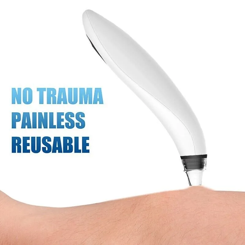 Electric Blackhead Remover Vacuum with Diamond Tip