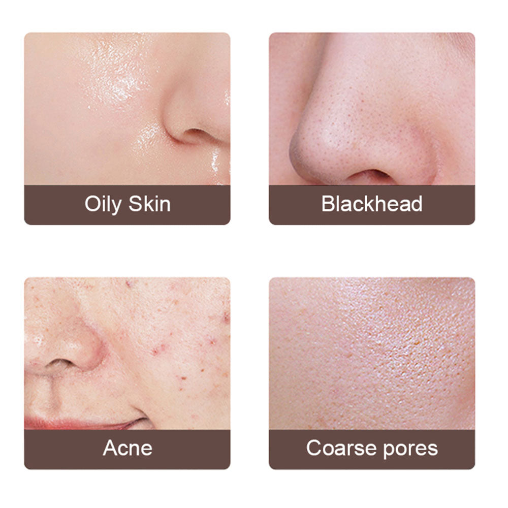 Ultrasonic Skin Scrubber with 4 Modes and Warm EMS
