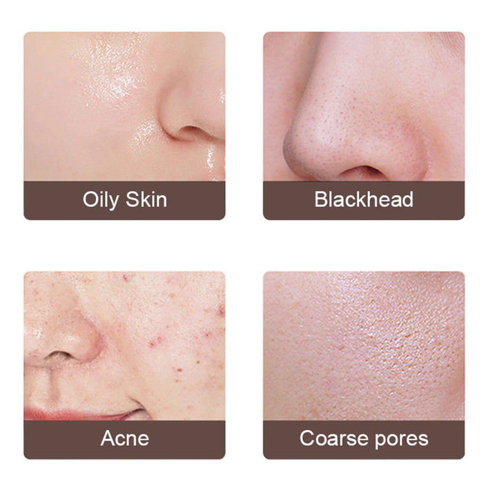 Ultrasonic Skin Scrubber with 4 Modes and Warm EMS