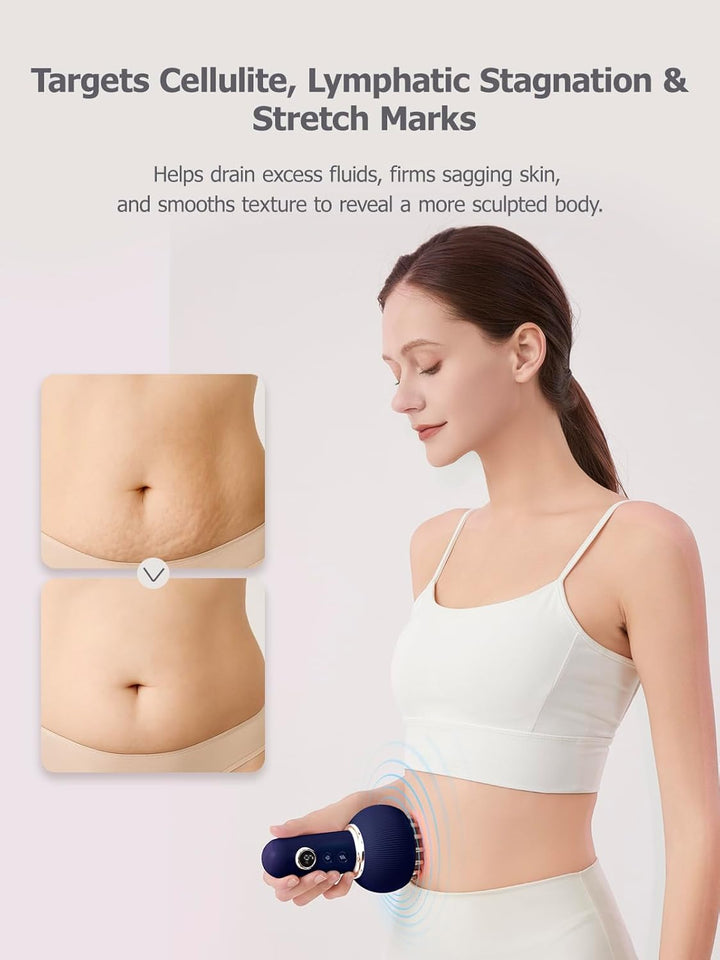 Cellulite Massager with Light, Heat and Vibration